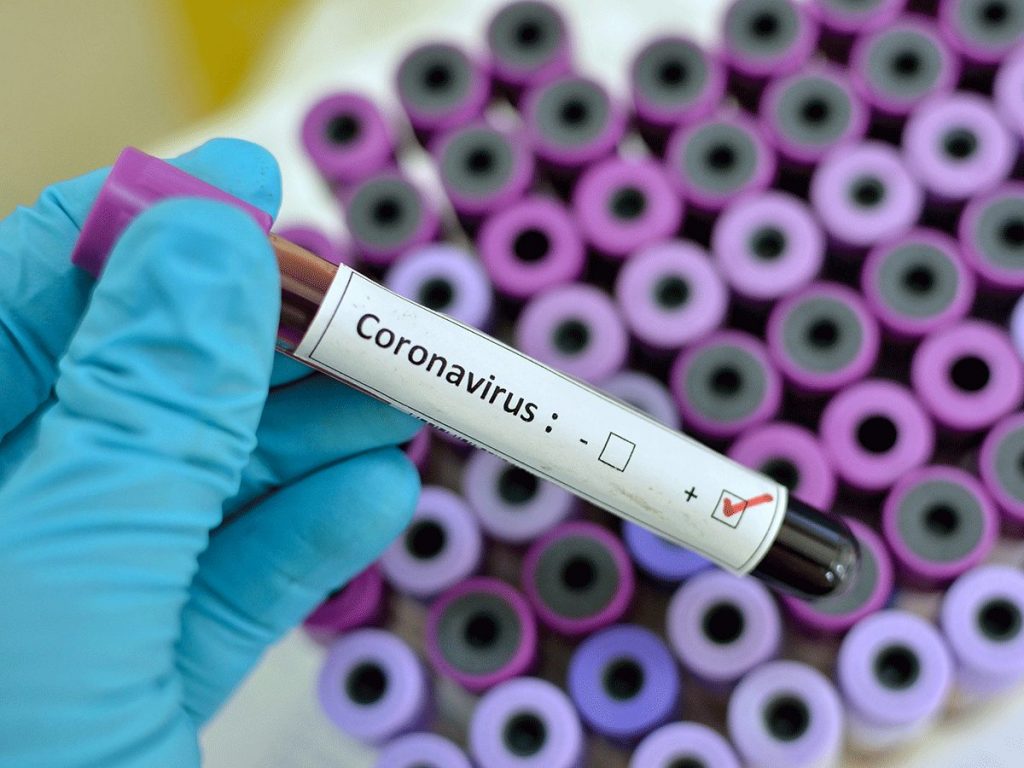 Now Coronavirus test will be held in Ahmedabad