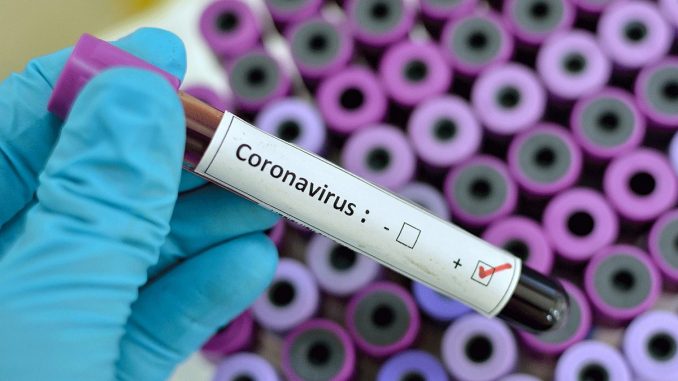 Now Coronavirus test will be held in Ahmedabad